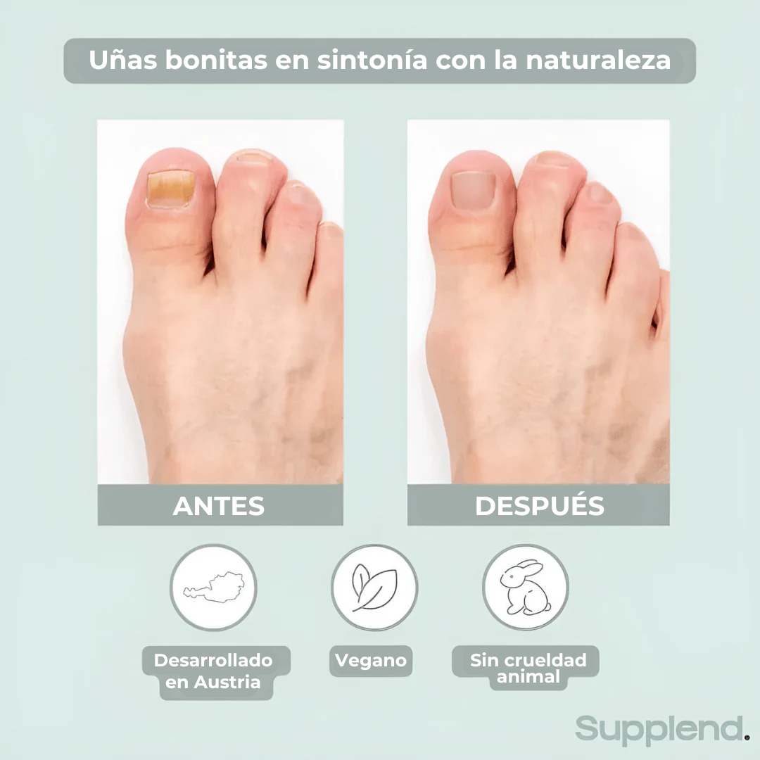 Reparador de Uñas